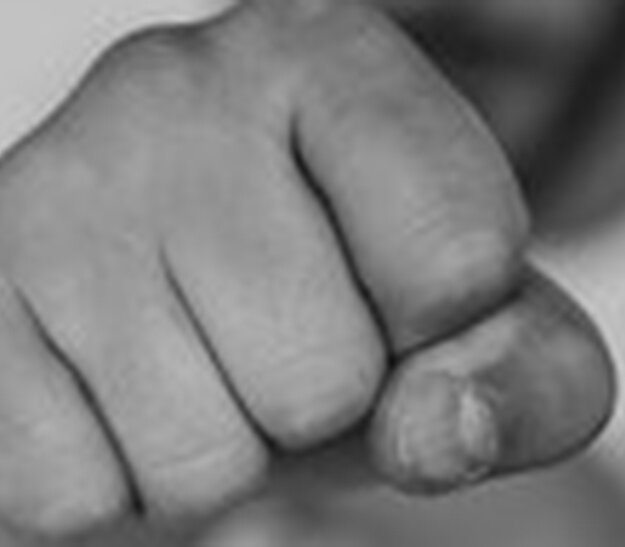 Ein geschlossener Handballen ist ins Bild gerichtet, die Finger sind zur Faust geballt. Der Hintergrund ist unscharf und nicht erkennbar.